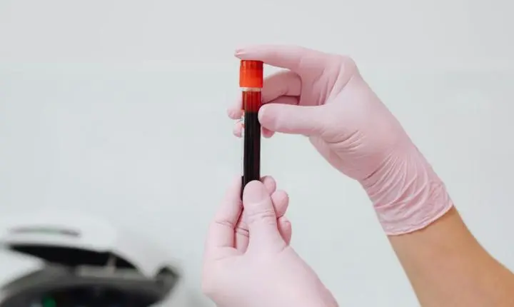 Iamspe integra rede que reaproveita sangue para produção de medicamentos